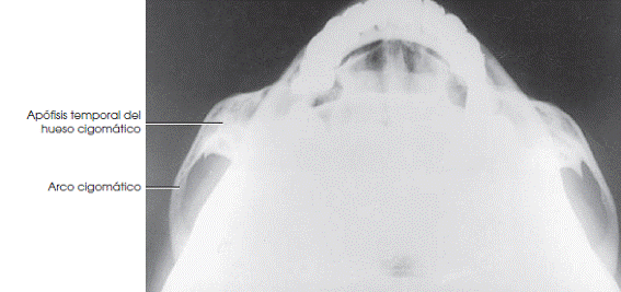 Anatomía arcos cigomáticos